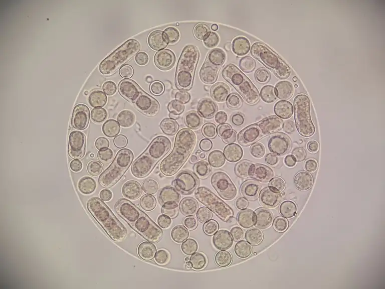 bacteria