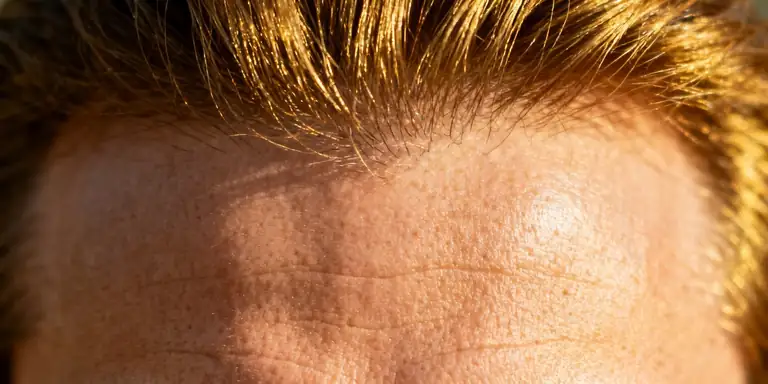 hairline